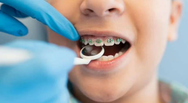 Когда нужен детский ортодонт, признаки неправильного прикуса у ребенка